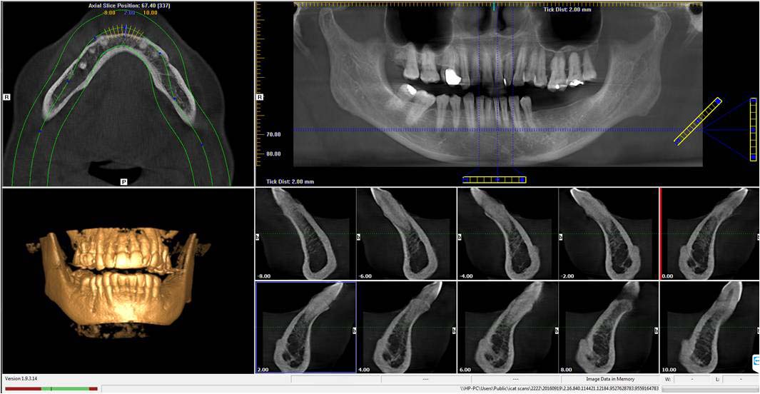Raydent i-CAT Dental and Maxillofacial Imaging Centre